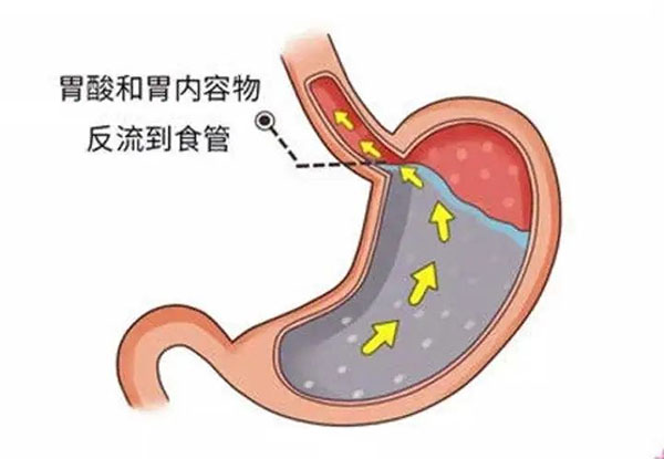 利发国际